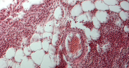 Phần phổi của con người