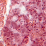 Phần của tuyến yên