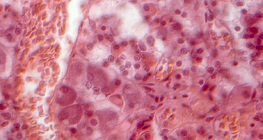 Phần của tuyến yên