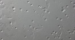 Các tế bào hồng cầu của một ấu trùng ruồi mắt đỏ