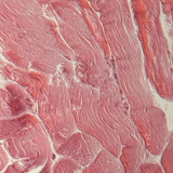 Gân (mặt cắt ngang)