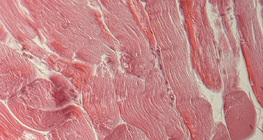 Gân (mặt cắt ngang)