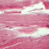 Gân (mặt cắt dọc)