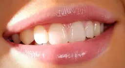 Chúng ta biết gì về răng?