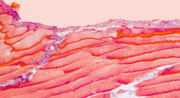 Những mô nào tạo nên cơ của chúng ta?