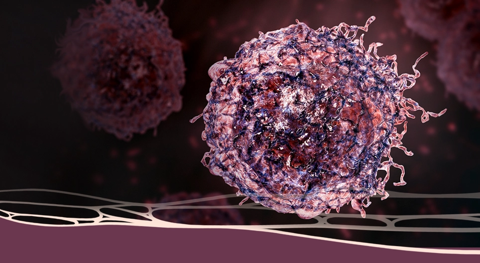 Chẩn đoán đáng sợ: Bệnh ung thư