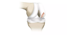 The biomechanical properties of articular cartilage