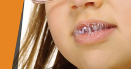 Nước bọt 'ăn mòn'