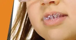 Nước bọt 'ăn mòn'