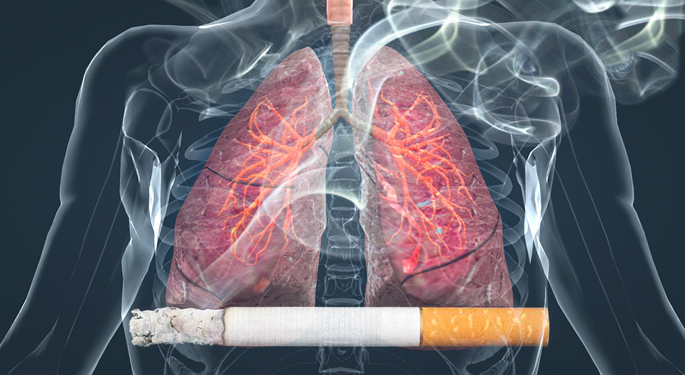 Ảnh hưởng của hút thuốc lá lên phổi