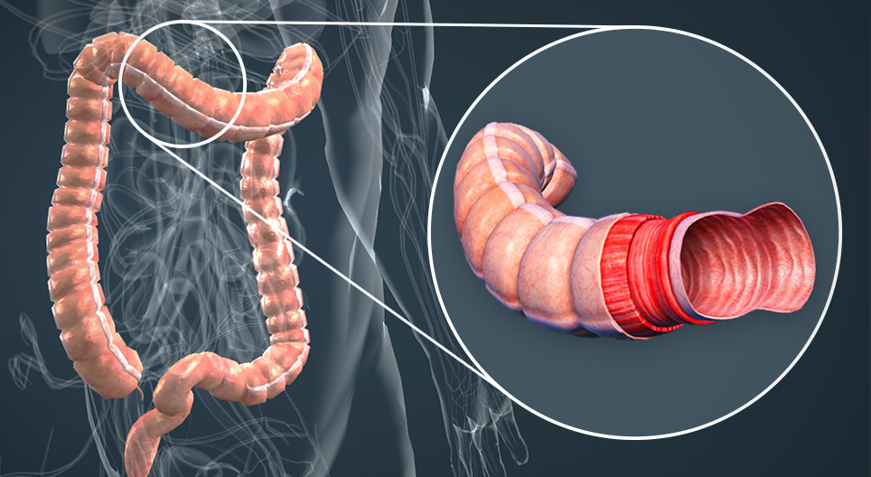 Giải phẫu đại tràng