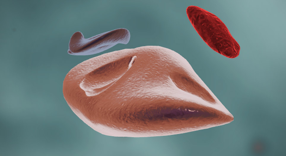 Enzyme